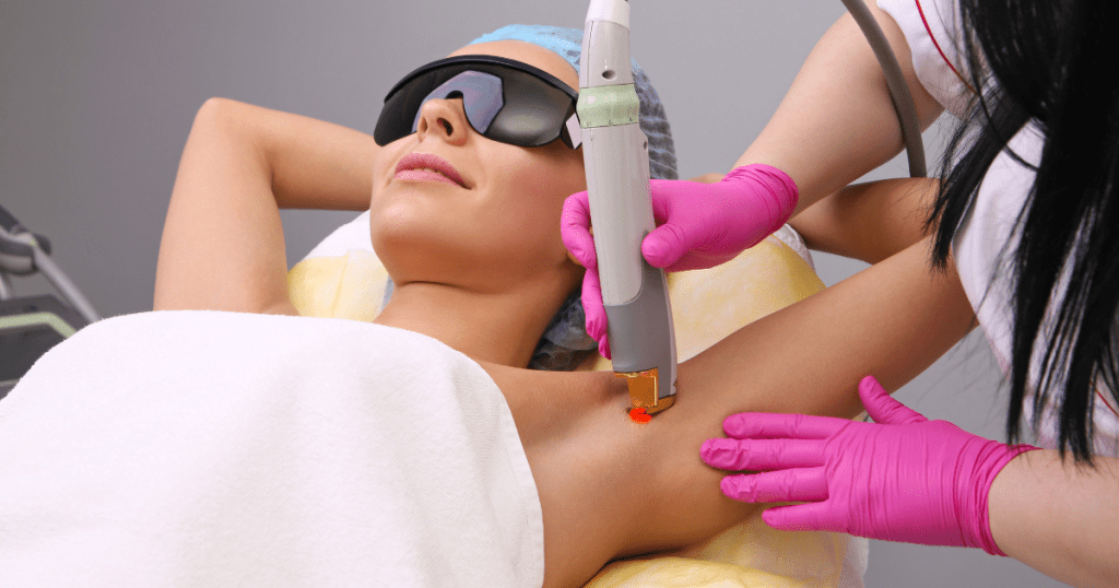 Laser Hair Removal