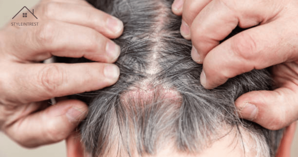 Why Hair Regrowth Itches 