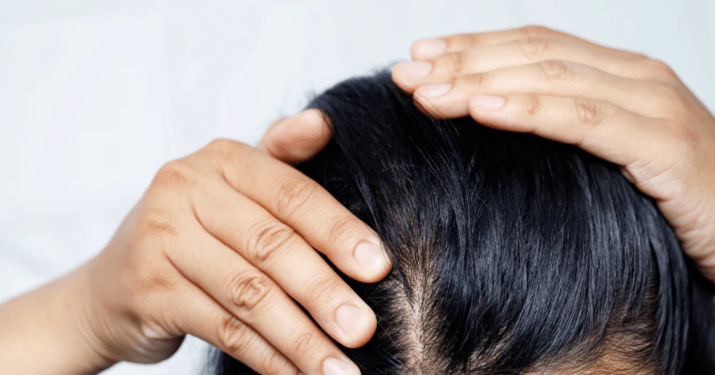  Causes of Visible Scalp Through Hair