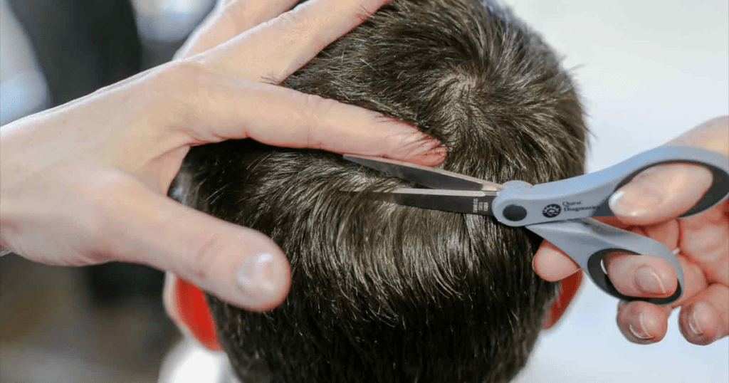 Factors Affecting Hair Follicle Test Results