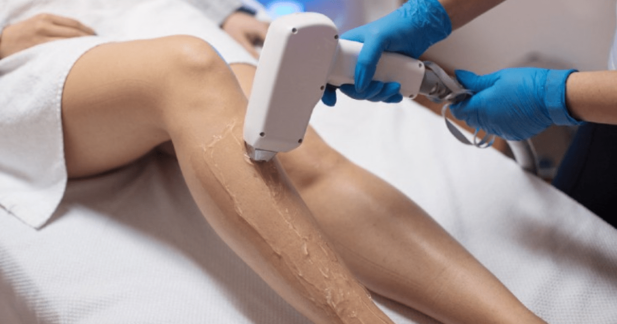 How Long Does Laser Hair Removal Take?