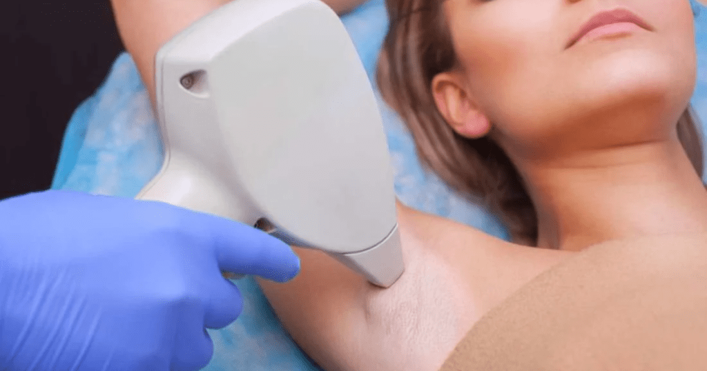 Laser Hair Removal