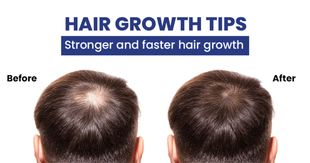 Tips for Healthy Hair Growth