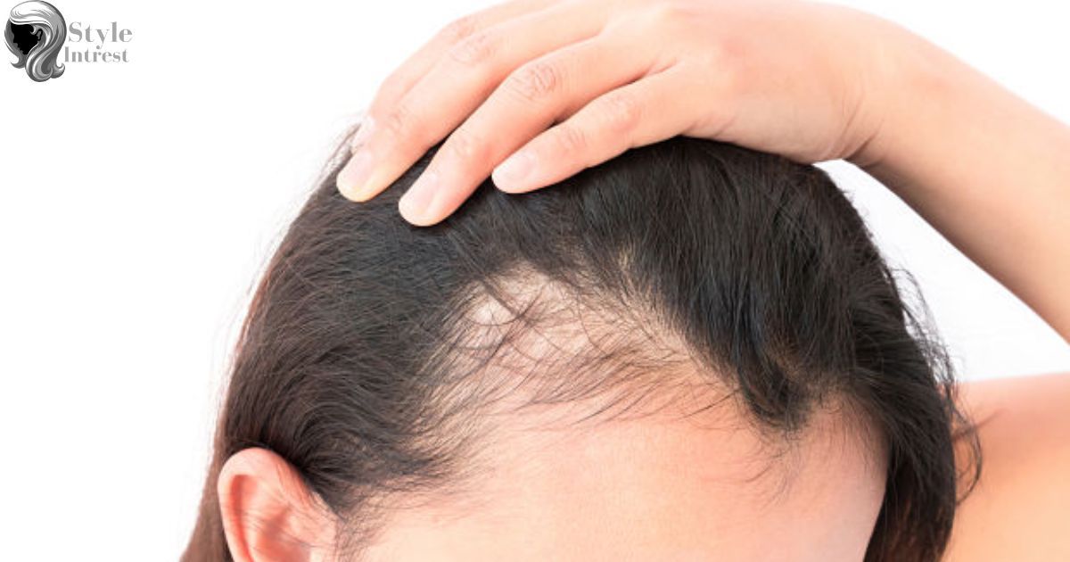 Hair Loss and Scarring