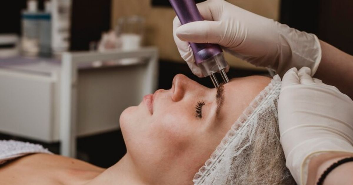 Alternatives to Laser Hair Removal for Tattooed Individuals