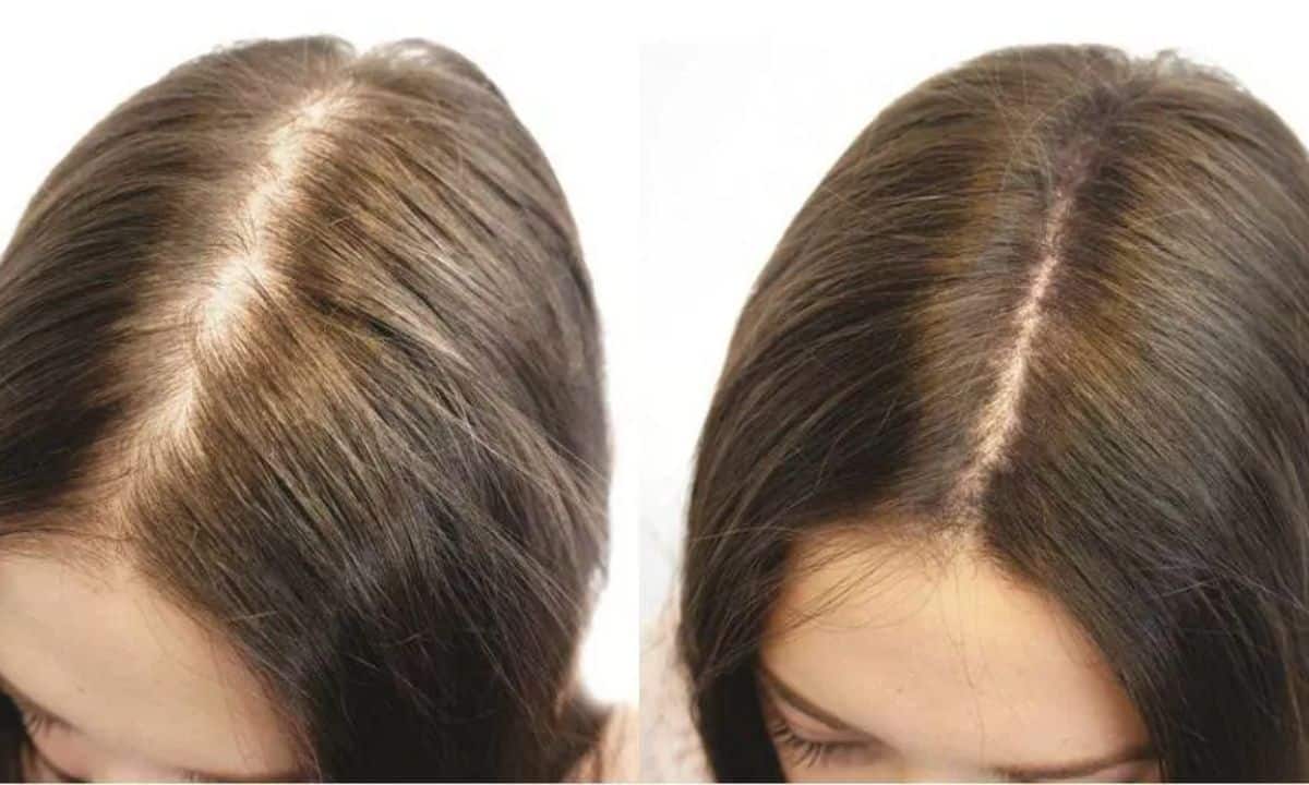 Factors Affecting Hair Growth