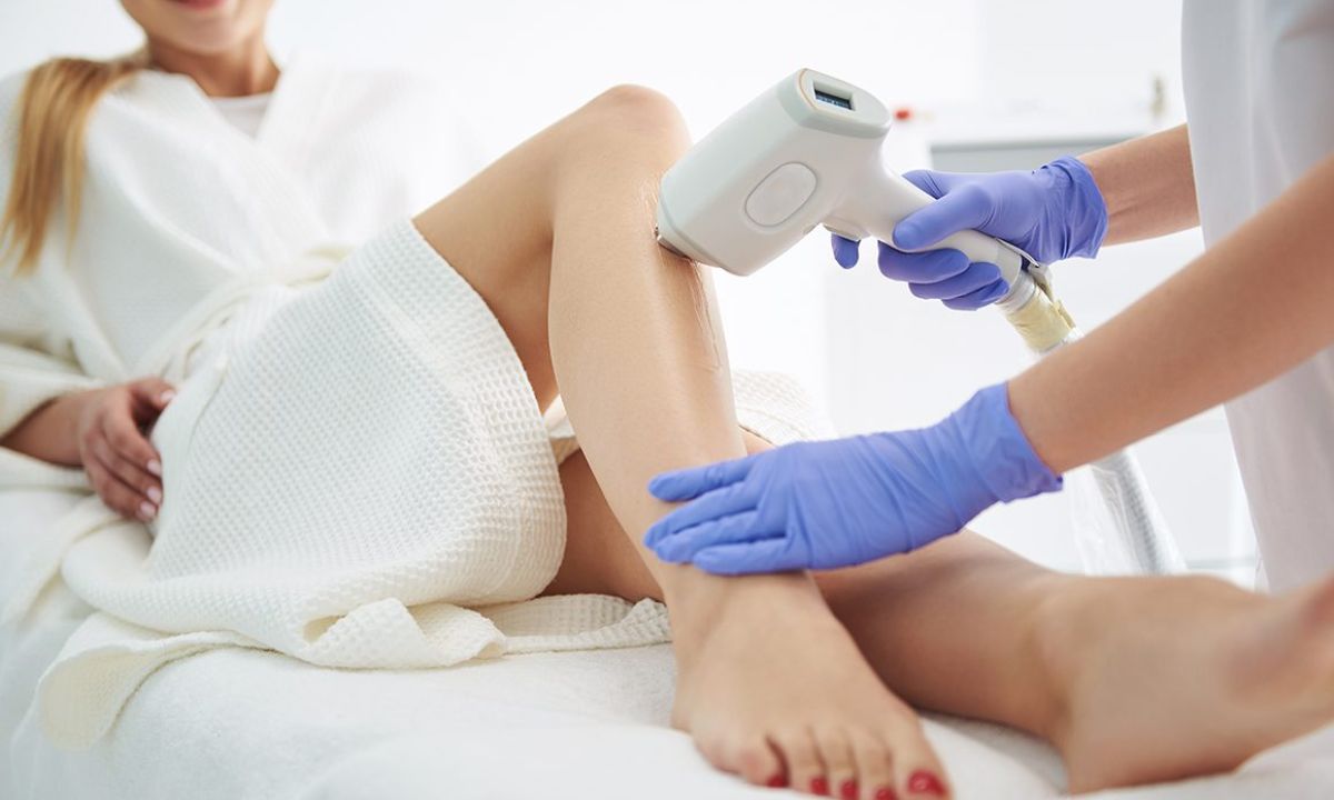 Factors Affecting Number of Laser Hair Removal Treatments