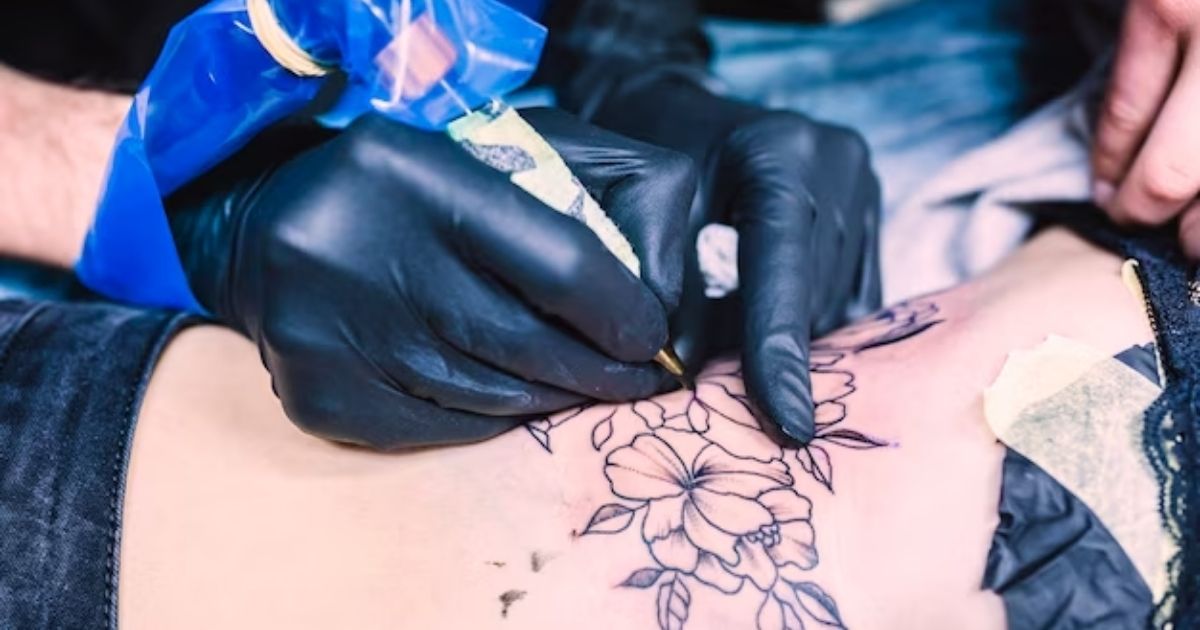 Fading and Distortion of Tattoo Design With Laser Hair Removal