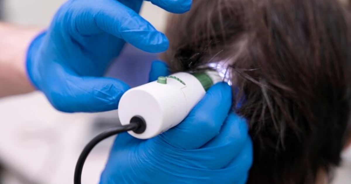 How Hair Follicle Tests Work