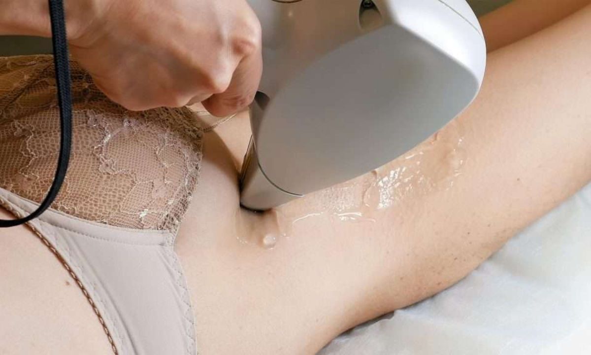 How Laser Hair Removal Works During Menstruation