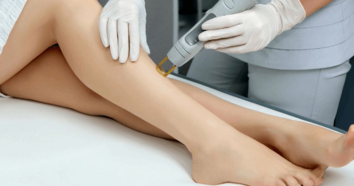 How Many Sessions of Laser Hair Removal for Brazilian?