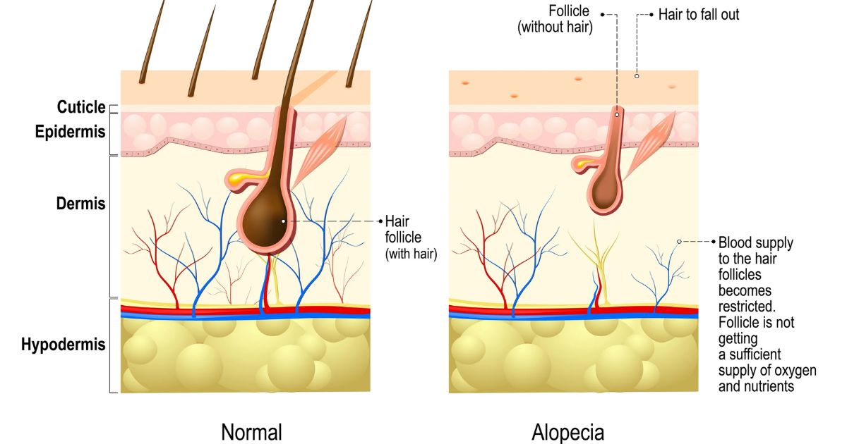 Understanding Hair Follicle Tests